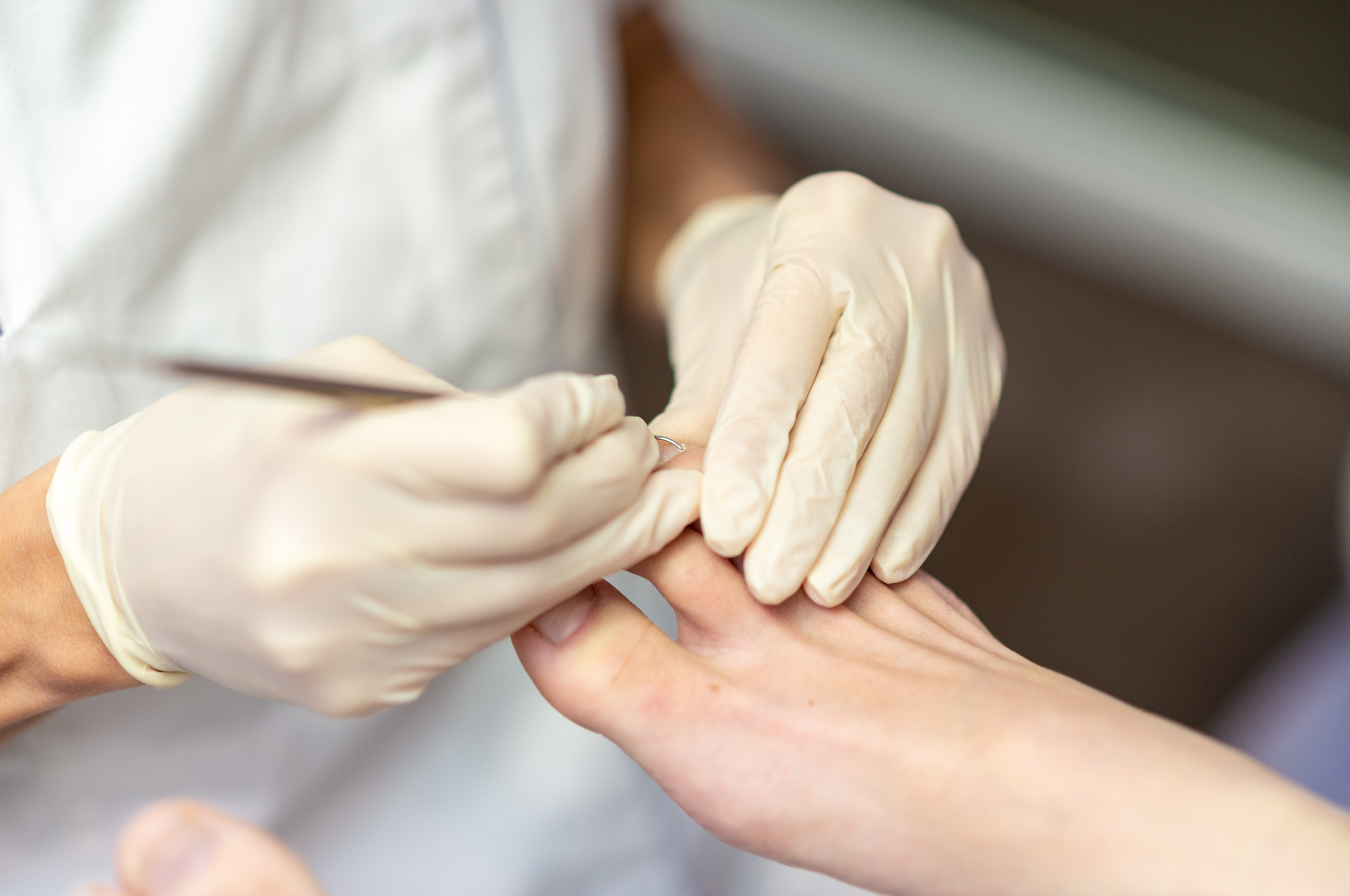 Pédicurie médicale Cabinet Hottinguer